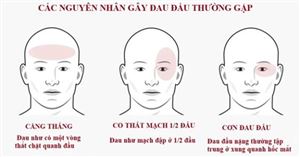 Khi nào đau đầu là dấu hiệu nguy hiểm bạn cần đi khám ngay?